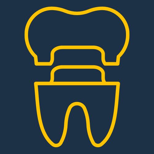 Dental Crowns and Bridges